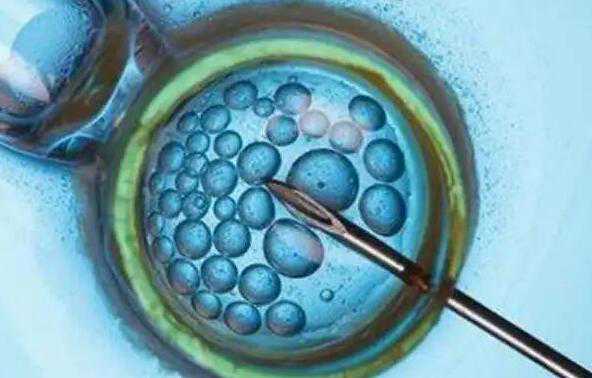 太原供卵的费用 2022年太原可以做三代试管的医院是哪家? ‘男孕囊和女孕囊的